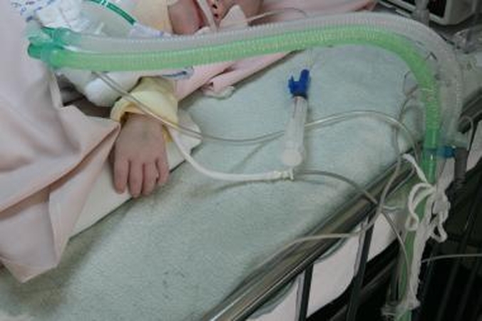 Vilniuje gydomas, kaip įtariama, neblaivios motinos sumuštas kūdikis