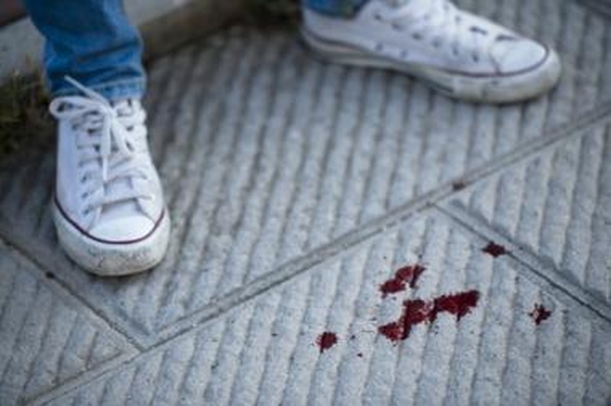 Jaunuolis kavinėje sumuštas metaliniu strypu
