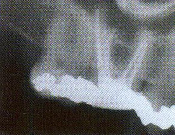 Endodontologo kabinetas — Dainavos poliklinikoje