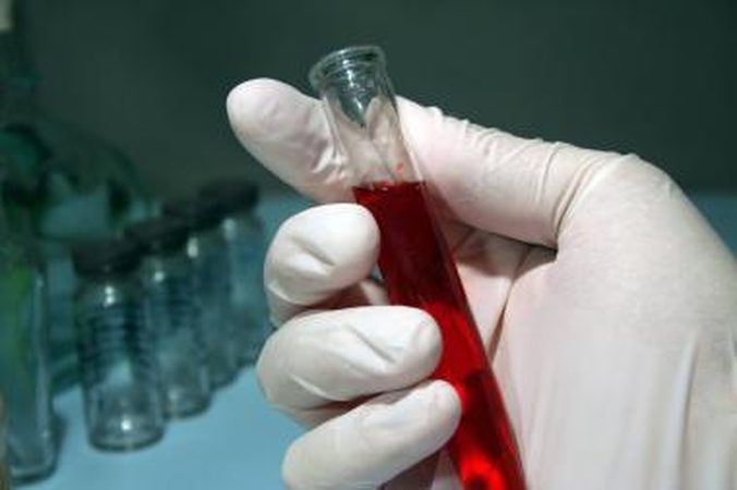 Pagerbė neatlygintinus kraujo donorus