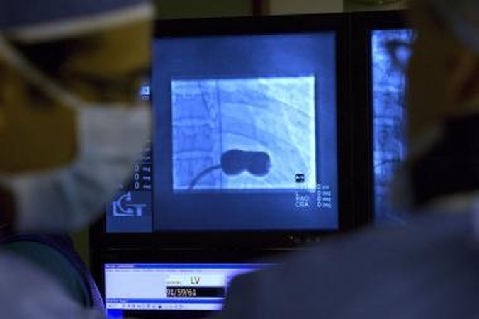 Vaikui pirmą kartą implantuota nuolatinė dirbtinė širdis