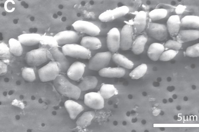 E. coli protrūkis Vokietijoje mažėja 