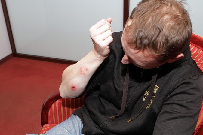 Klaipėdoje girtas vyras sukandžiojo policininką