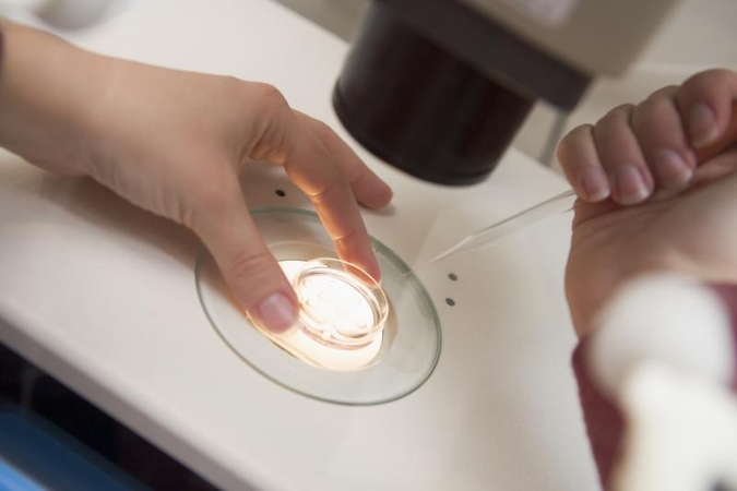 Dirbtinai išaugintas žmogaus kiaušialąstes siekiama apvaisinti 