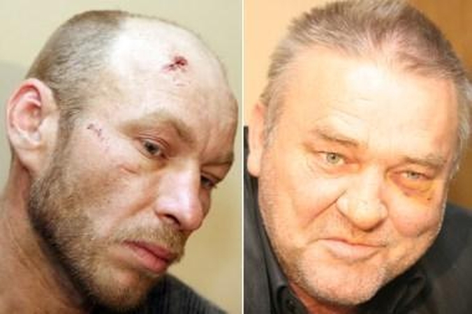 Psichiatrai aiškinsis, ar galvą klaipėdiečiui nupjovė būdami sveiki