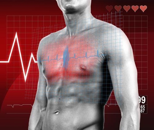 Vakcina nuo infarkto?