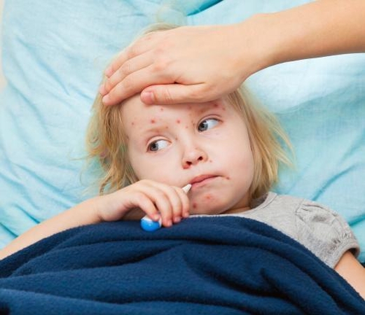 Vėjaraupiai mėgsta uždaras patalpas