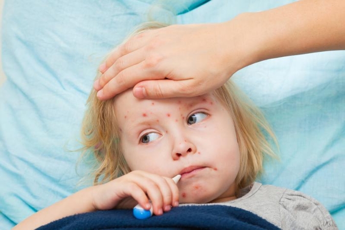 Vėjaraupiai mėgsta   uždaras patalpas   